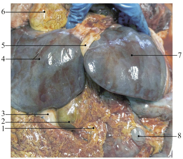 Синдром зеркального расположения органов брюшной полости человека thumbnail